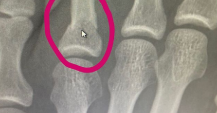 KHABIB OBJAVIO DOKAZE, za sve koji nisu vjerovali: Izašao je povrijeđen i pobijedio (FOTO)