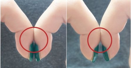 SPOJTE DVA KAŽIPRSTA I DOBRO POGLEDAJTE U JEDNU STVAR! Ovaj test od DVIJE SEKUNDE MOŽE VAM SPASITI ŽIVOT