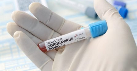 PETORO LJUDI ŽIVOTNO UGROŽENO U kovid bolnici u Bijeljini danas hospitalizovano najviše pacijenata