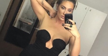 KAKO ĆE IZGLEDATI POSLIJE: Senidah se odlučila na neobičan tretman lica, pa objavila fotografiju