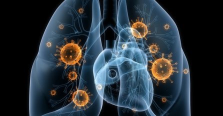 EVO KAKO SE VIRUS RAZLIKUJE OD UPALE PLUĆA Naučnik otkrio i kako dolazi do dugog kovida