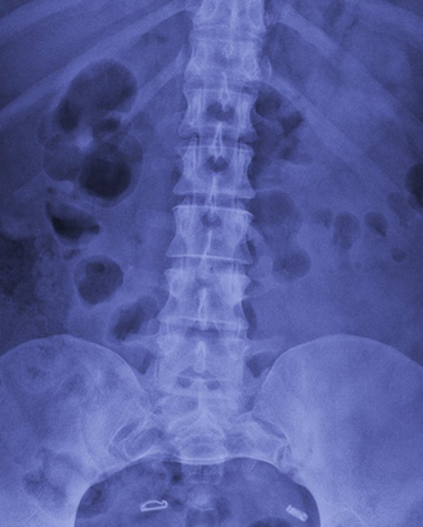 about-section-rtg-usluge-003