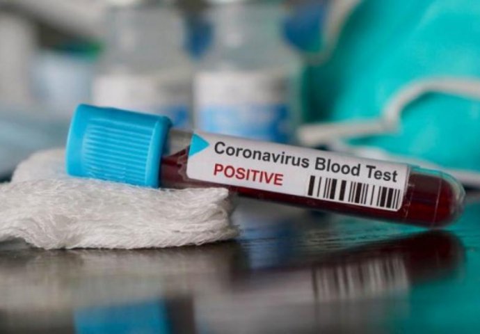 U Bosni i Hercegovini 330 novozaraženih koronavirusom, preminulo 16 osoba
