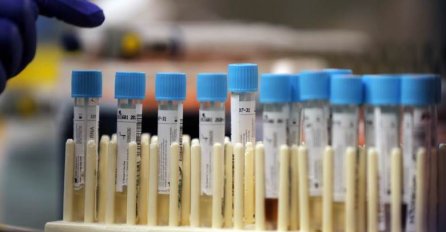 NOVE BROJKE U SARAJEVU: Više od 660 novozaraženih