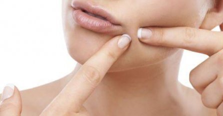 BUBULJICE UKAZUJU NA BOLESTI! Ako imate promjene na obrazima, MOGUĆE DA VAM OTKAZUJE JEDAN ORGAN