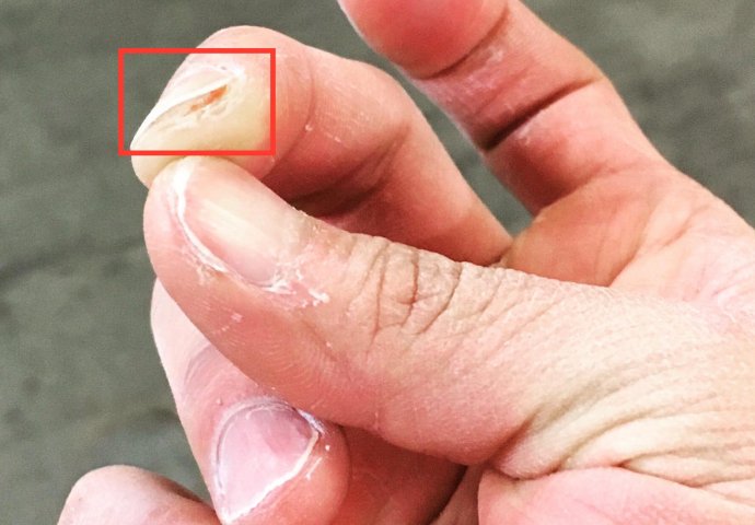 LISTAJU VAM SE NOKTI? Ovo bi mogli biti razlozi OBRATITE PAŽNJU