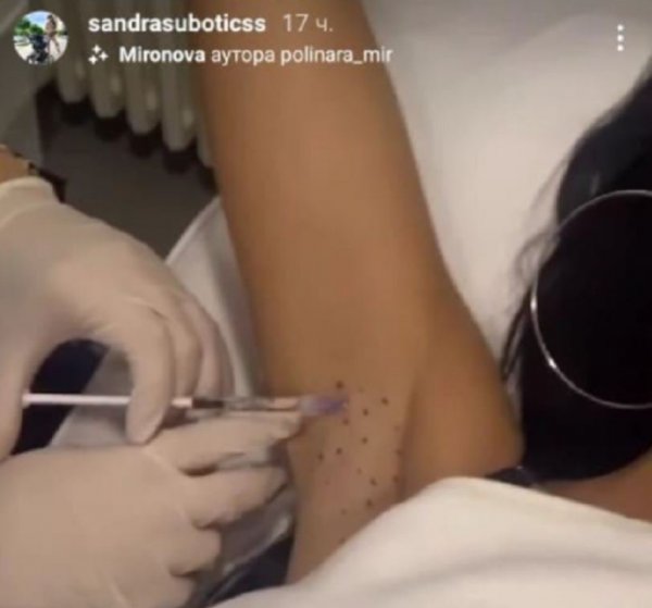 390757-botoks-jpg-orig