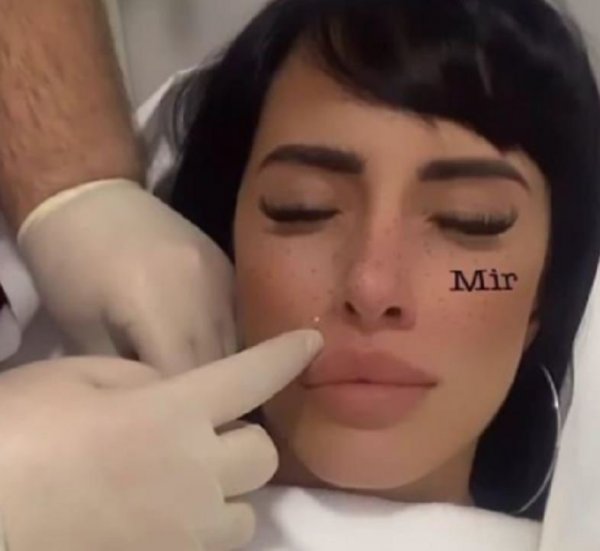 390758-botoks1-jpg-orig