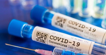 PORUKA VODEĆEG EPIDEMIOLOGA "Obični građani" će dobiti vakcinu do kraja juna