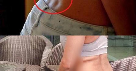 Ako imate OVE DVIJE RUPICE NA LEĐIMA, ONDA STE ZAISTA POSEBNI: Niste ni svjesni koliko ste SRETNI, EVO I ZAŠTO