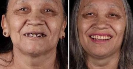 Bili su KREZAVI I SIROMAŠNI, a onda su STAVILI PROTEZE: Past ćete sa stolice kad vidite broj 6, TRANSFORMACIJA STOLJEĆA (FOTO)