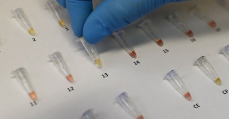 Zbog koronavirusa mogla bi se razbuktati jedna opasna starija pandemija