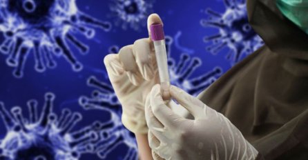 U BiH 578 novozaraženih osoba, nisu prijavljeni smrtni slučajevi od COVID-19