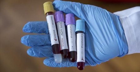 PREMINULO VIŠE OD 8.600 LJUDI Prvo vakcinisati starije i bolesne