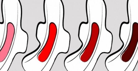 BOJA MJESEČNICE OTKRIVA OD ČEGA BOLUJETE: Ako uočite ovo na ulošku, ODMAH IDITE GINEKOLOGU!