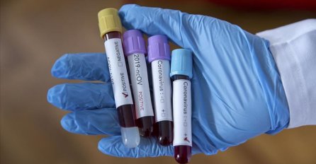 SVE VIŠE LJUDI U BOLNICAMA I NA RESPIRATORIMA Na Kosovu preminulo 11 ljudi, još 855 zaraženo