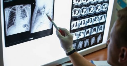 Virusolog Šukrija Zvizdić: Dva miliona ljudi godišnje i dalje umire od tuberkuloze