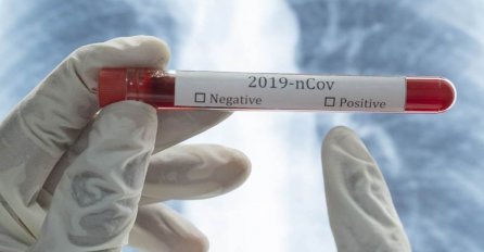 U BiH u nedjelju 689 novozaraženih i 28 umrlih