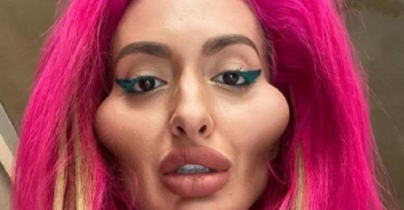 ANASTASIJA IMA NAJVEĆE OBRAZE NA SVIJETU, A NEKAD JE BILA LJEPOTICA: Ljudi u šoku kad su vidjeli stare slike (FOTO)