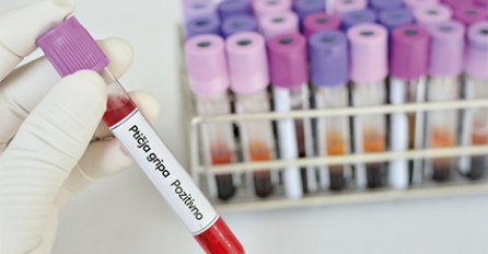 OPASNA BOLEST Ptičiji grip registrovan i u Sloveniji