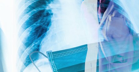 SZO NE KRIJE ZABRINUTOST “U prethodnoj nedjelji najviše novooboljelih na svijetu dosad”