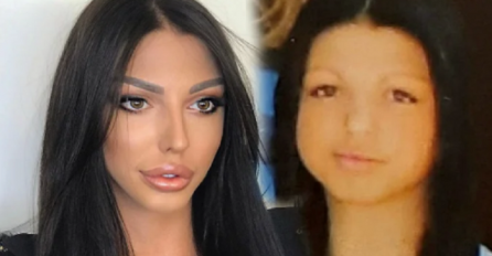 MAJA MARINKOVIĆ OPERISALA CIJELO LICE - a evo koliko je platila plastičaru: Oglasio se i njen otac, VELIKA SUMA JE U PITANJU