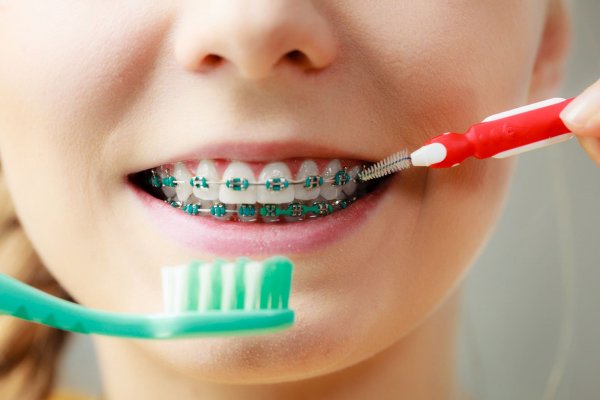 brush-teeth-orthodontist