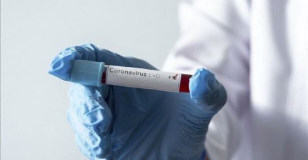 U Crnoj Gori registrovano 427 novih slučajeva korona virusa