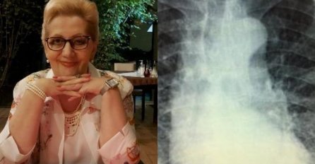 Doktorica Slavica Plavšić putem Twittera spasila život čovjeku oboljelom od COVID-a: "Doktorice, molim vas pomozite..."