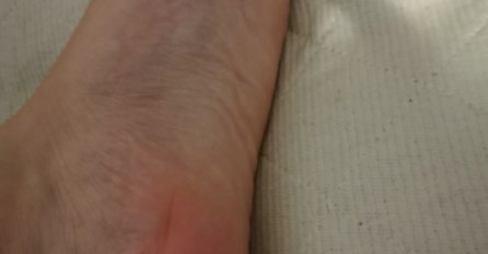 STOPALO VAM SE ODJEDNOM ZACRVENI, KAO DA GORI? Evo šta je u pitanju! OVO VAM SE DOGAĐA U ORGANIZMU