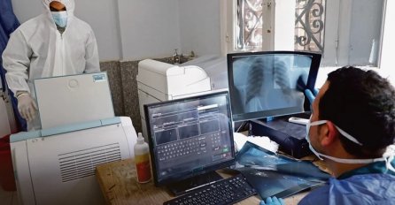 Radiolog iz Niša u 4 SLIKE pokazao šta korona radi plućima: "Ovo nije isto kao grip!"