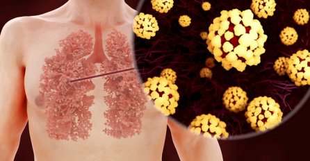 Da li snimak može da otkrije koronu i kada je test negativan i kako izgledaju pluća oboljelih?