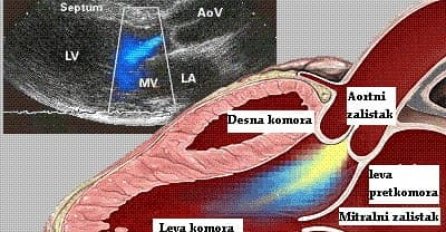 Ovo svi trebate znati o bolesti od koje je umro Džej: Bitno je da se na vrijeme prepozna i liječi