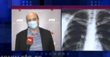 Upozorenje doktora Ivkovića: Postoji 5 ZNAKOVA da je korona uzela maha i da se obavezno javite ljekaru, STANJE SE MOŽE BRZO ZAKOMPLIKOVATI