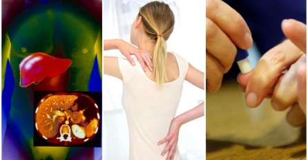 Ovo su simptomi koji upućuju na to da ste možda preboljeli covid