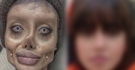 SJEĆATE SE ZOMBI ANĐELINE?  STRAVIČNO OSUĐENA ZBOG IZGLEDA: A evo kako je izgledala prije, BILA LJEPOTICA (FOTO)