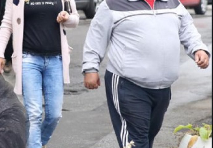 OPERACIJA ŽELUCA JE OPASNA, EVO ŠTA SE SVE MOŽE DESITI NAKON NJE: Darkov otac je umro ZBOG komplikacija nakon operacije