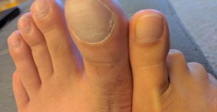 "ŽENA I JA SMO UPOREDILI NOŽNE PRSTE", A TEK DA VIDITE SLIKU BROJ 3: Ove fotke će vas izbezumiti, uvjerite se i sami