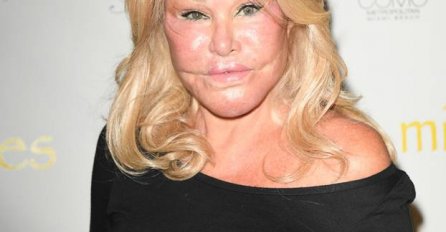 MILIJUNAŠICA ZAPREPASTILA LICEM, A ZARUČNIK TVRDI: "Nije se operisala" A POGLEDAJTE KAKO JE IZGLEDALA PRIJE (FOTO)