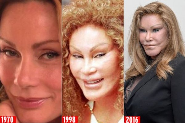 main-jocelyn-wildenstein