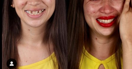 ZUBAR SIROMAŠNIMA POKLONIO NOVI OSMIJEH: Pogledajte kako sada izgledaju, SLIKA BROJ 5 SVE OSTAVLJA U ŠOKU (FOTO)