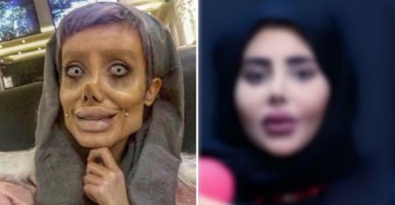 EVO KAKO STVARNO IZGLEDA ZOMBI ANGELINA JOLIE: Snimka nakon puštanja iz zatvora otkrila njeno pravo lic