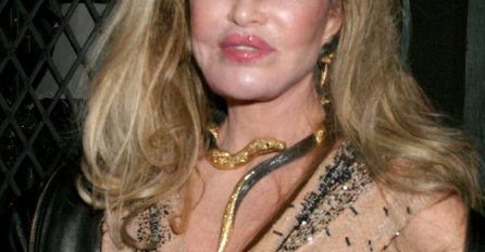 SJEĆATE SE ŽENE MAČKE? Operisala se do besvijesti da bi udovoljila mužu koji je obožavao MAČKE: Evo kako danas izgleda, STRAŠNO