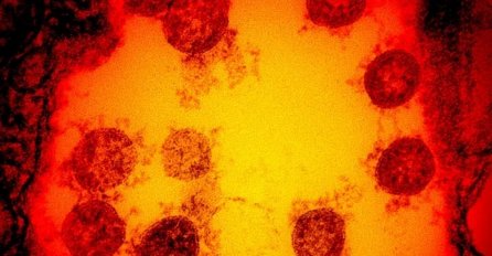 U Srbiji preminulo 5 osoba od posljedica koronavirusa, zaraženo još 76 osoba