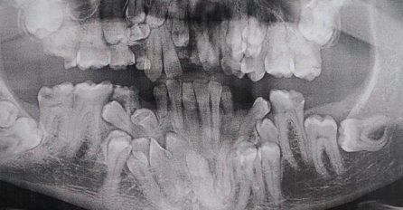 OTIŠAO JE KOD ZUBARA DA SNIMI RENDGEN ZUBA, kad su ovo vidjeli uhvatili se za glavu: Ovi ljudi su ostavili svijet u čudu, A ČEKAJTE TEK DA VIDITE SLIKU BROJ 2