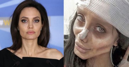 DVOJNICA ANĐELINE DŽOLI DOBILA 10 GODINA ZATVORA: Izgledom je ZGROZILA svijet, a evo zbog čega je sad završila IZA REŠETAKA (FOTO)