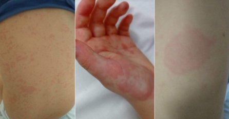 Jasminki su ljekari rekli da Petar (9) ima BAKTERIJSKU INFEKCIJU: "Osjećala sam da to nije to. Bio je negativan na Kovid, ali INSTINKT MI JE GOVORIO ŠTA JE"