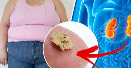 EVO KOJI JE PRVI ZNAK DA IMATE KAMENAC U BUBREGU: Idite hitno kod doktora ako vam se ovo dešava u toaletu!