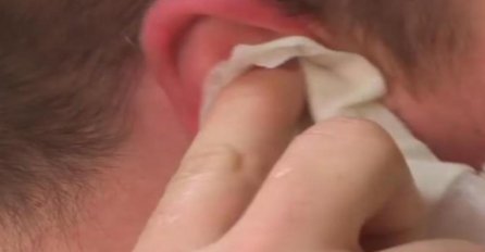 BOLJELO GA UHO, A ONDA SU MU LJEKARI OVO IZVADILI: Evo šta mu je raslo unutra, snimak ostavio sve u čudu (VIDEO)