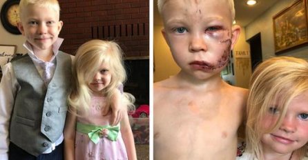 Sjećate li se dječaka koji je spasio sestru od psa? EVO KAKO DANAS IZGLEDA (FOTO)